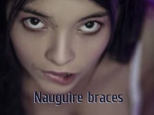 Nauguire_braces